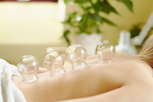 カッピングを付けた背中