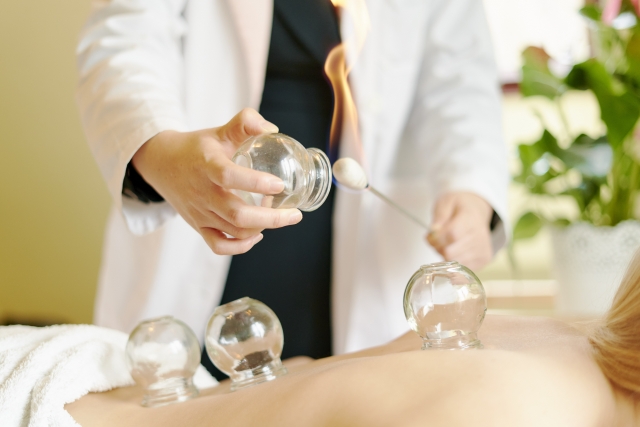 カッピングを付けるとき